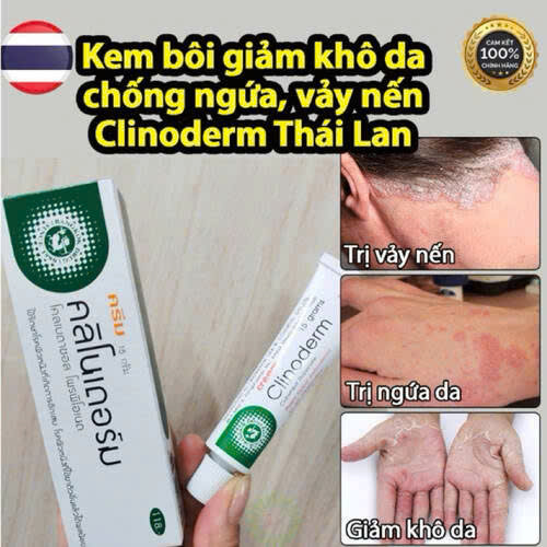 Kem Bôi Da Điều Trị Vảy Nến Clinoderm(Tuýp/15g)Thái - 0938416889